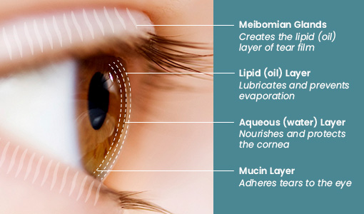 About Dry Eye Disease | Dry Eye